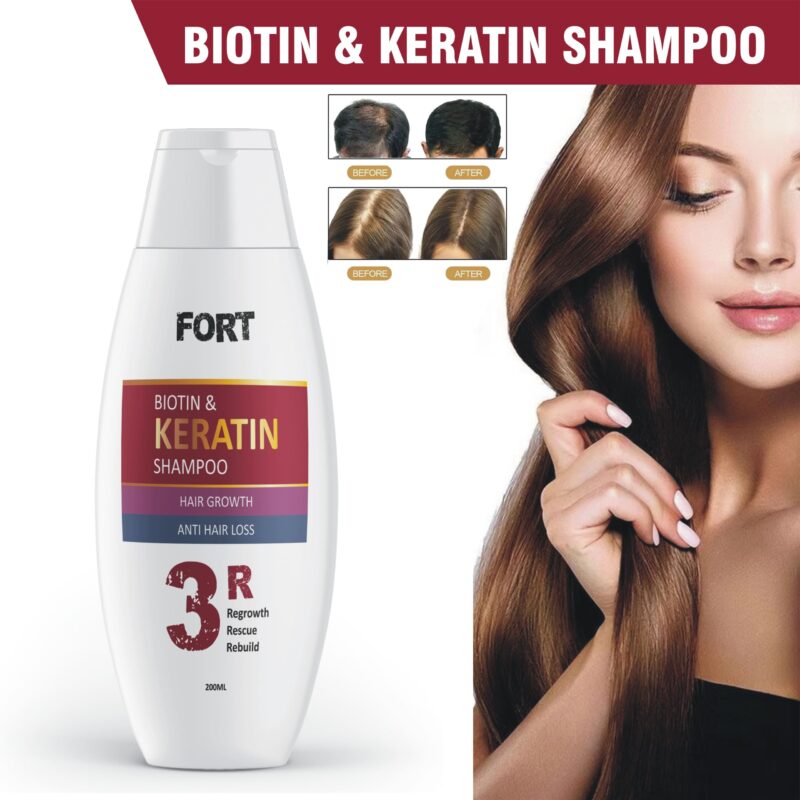 FORT Biotin & Keratin Anti Hair Loss & Hair Regrowth Shampoo (200ml)