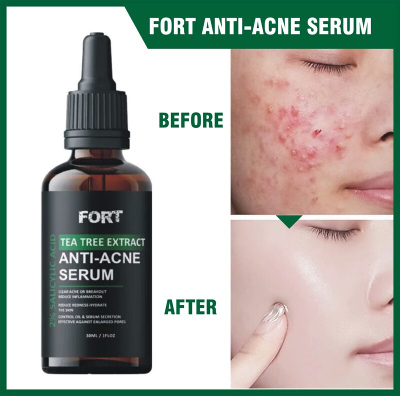 FORT Tea Tree Anti-Acne Serum (30ml)