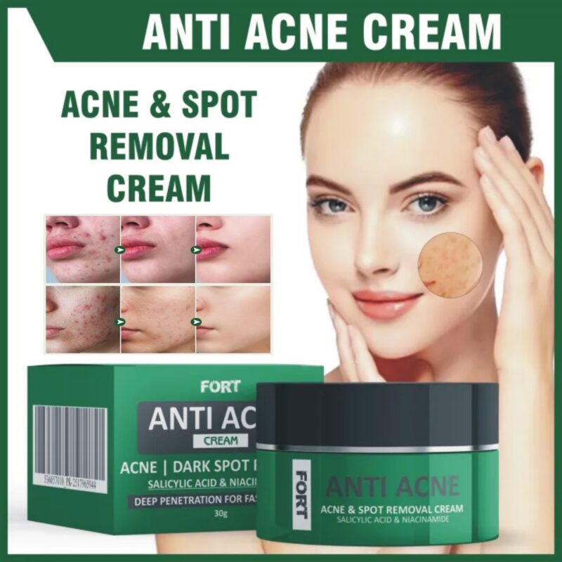 FORT Anti Acne Cream – Acne & Dark Spot Removal With Salicylic Acid & Niacinamide