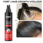 FORT Minoxidil Hair Growth Spray (120ml)