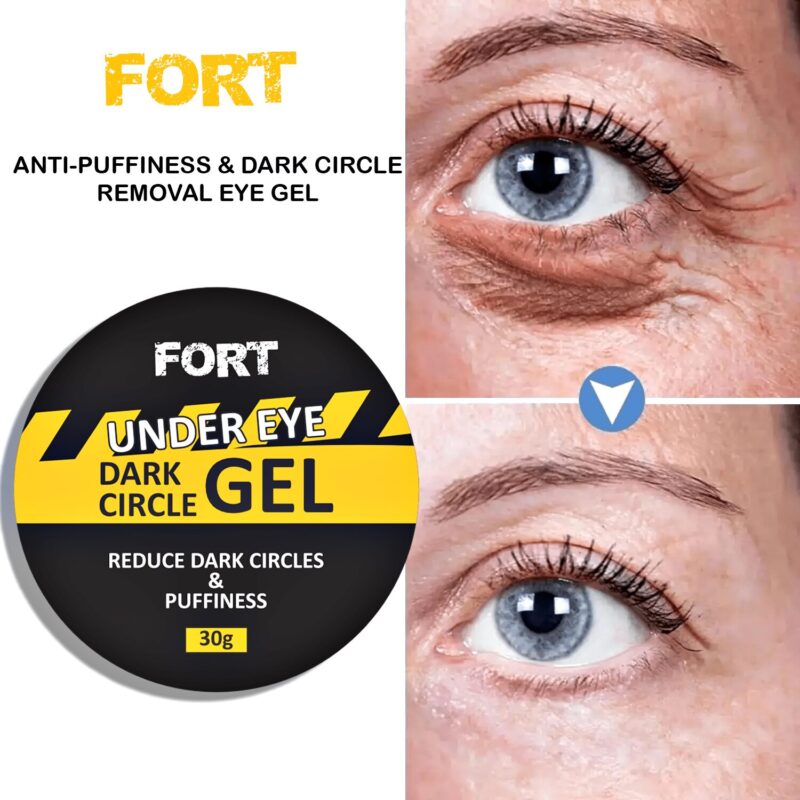 FORT Under Eye Gel Remove Dark Circles Fades (30gm)