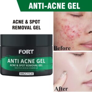 Fort Anti Acne Gel For Acne & Spot Removal (75gm)