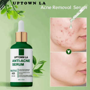 Uptown LA Anti-Acne Face Serum (30ml)