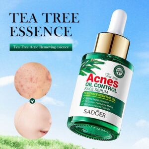 SADOER Acnes Tea Tree Essence Oil Control Face Serum (30ml)
