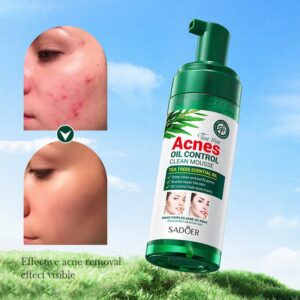 SADOER Tea Tree Mousse Facial Cleanser (150gm)