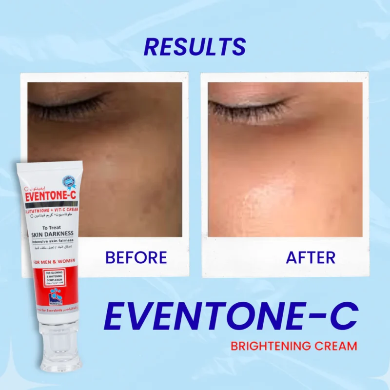 Eventone-C Glutathione + Vitamin-C Cream - Image 3